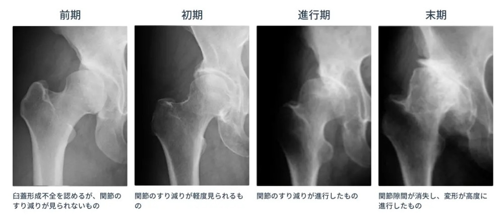 画像 126